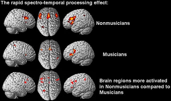 Music benefits your brain 
