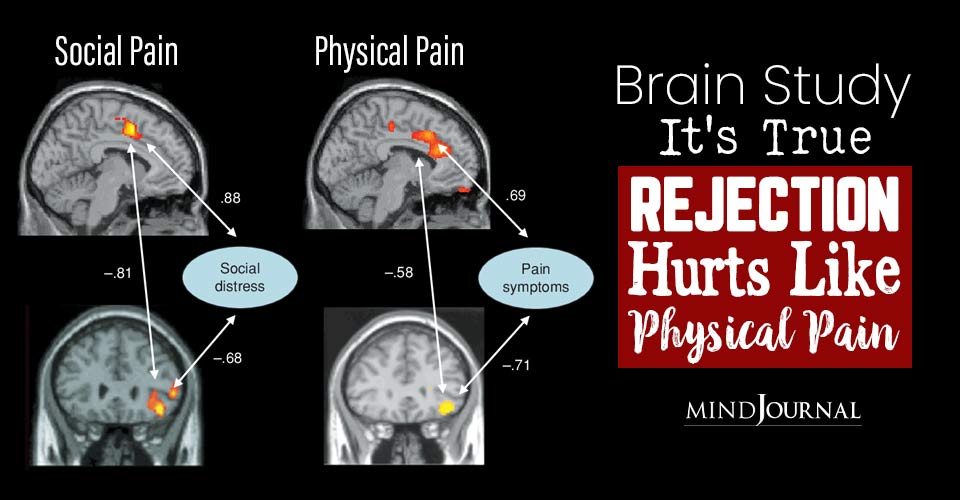 Brain Study: It’s True, Rejection Hurts Like Physical Pain