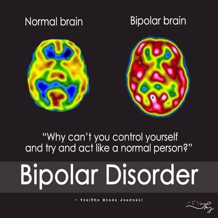 Normal Brain V/s Depressed Brain