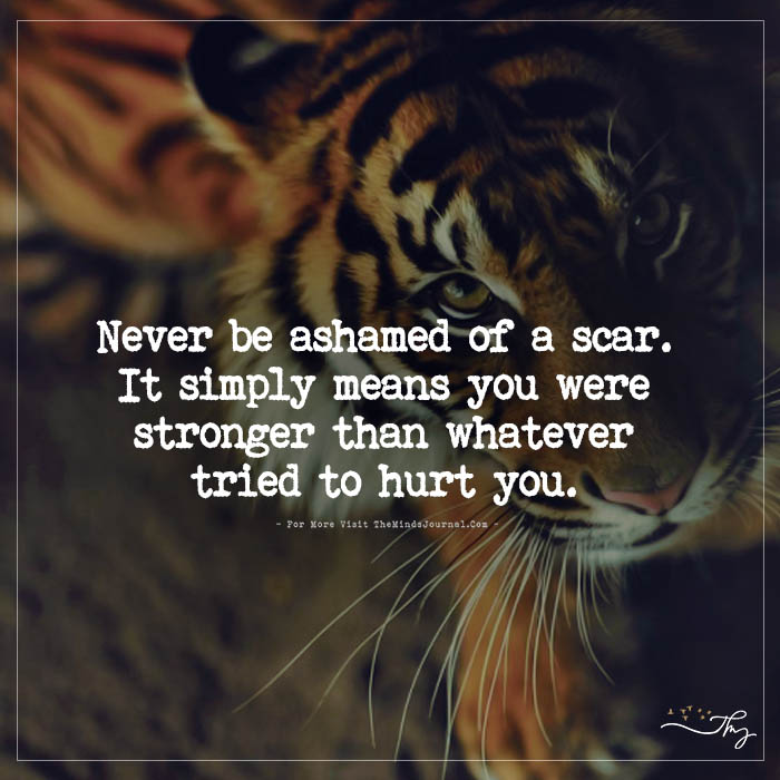 Never Be Ashamed Of A Scar