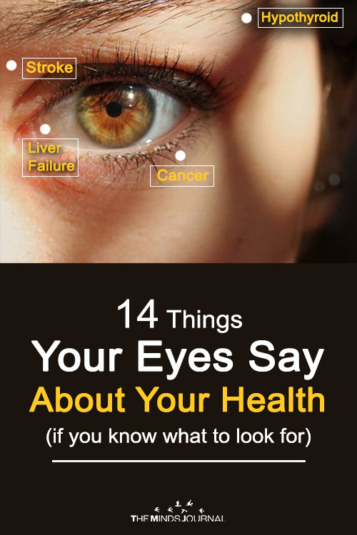 14 Things Your Eyes Say About Your Health (if you know what to look for)