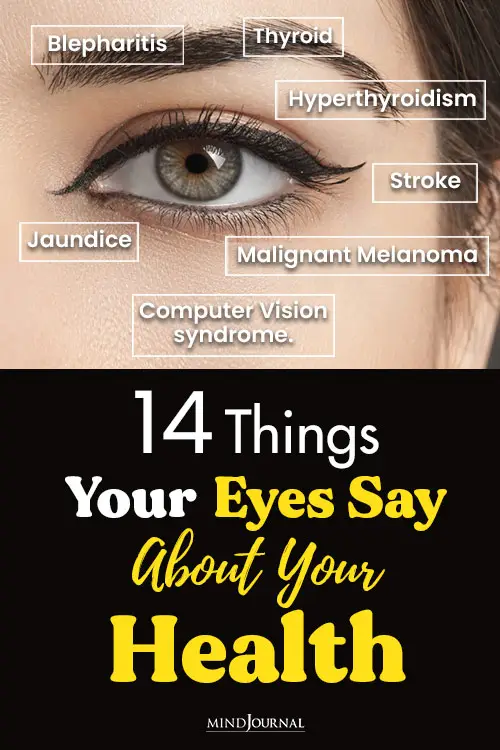 Things Eyes Say About Health pin