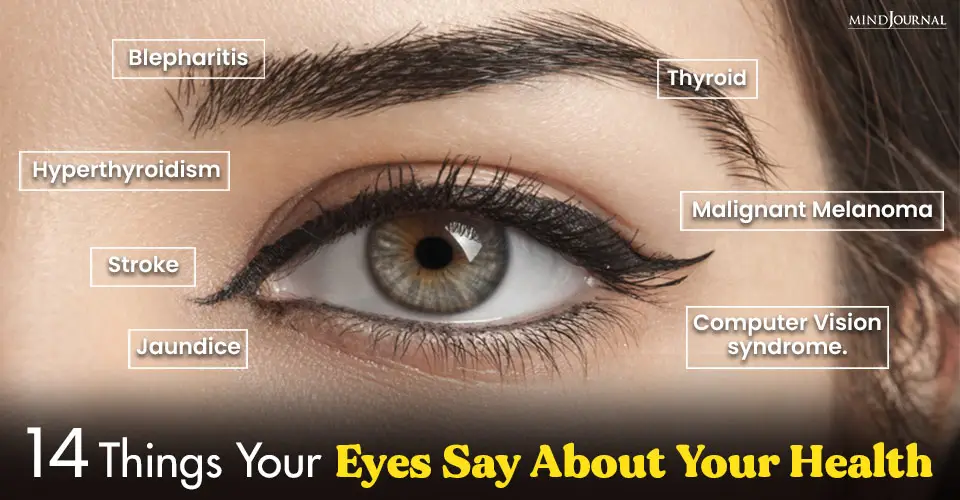 14 Things Your Eyes Say About Your Health