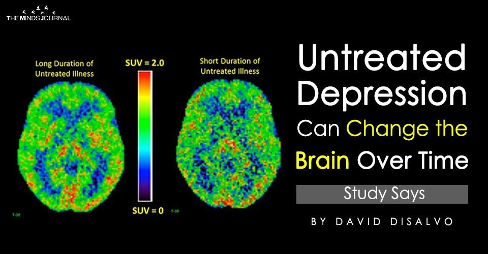 Untreated Depression Can Change the Brain Over Time