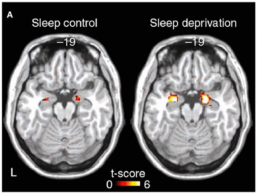 sleep control vs sleep deprivation