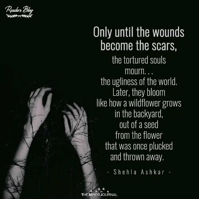 Until the wounds become the scars