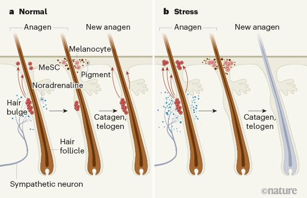 stress causes premature hair greying