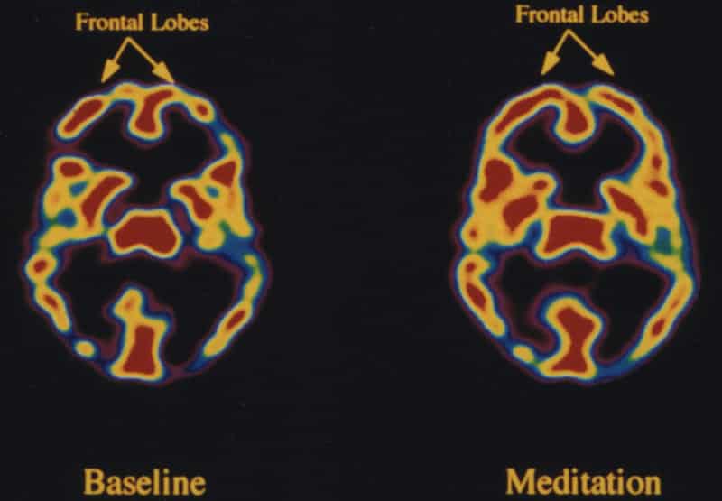 effect of meditation on brain