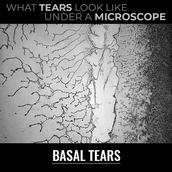 Basal tears under microscope