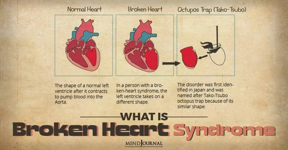 What Is Broken Heart Syndrome and Tips To Prevent