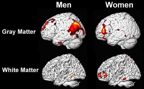 men and women brain 