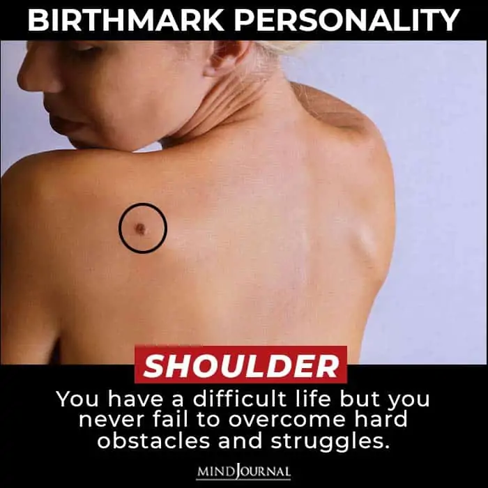 Birthmark Meaning