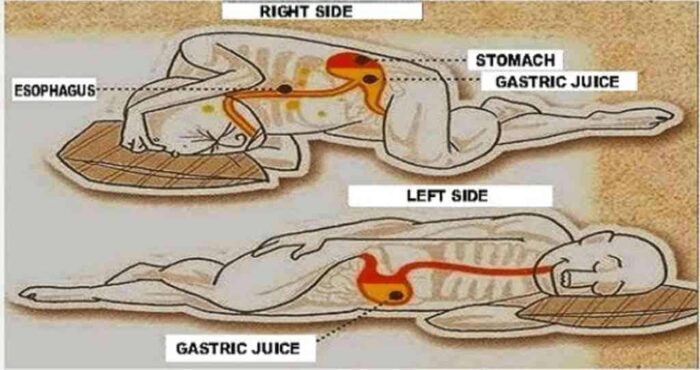 Gastric juices Sleeping On Left Side