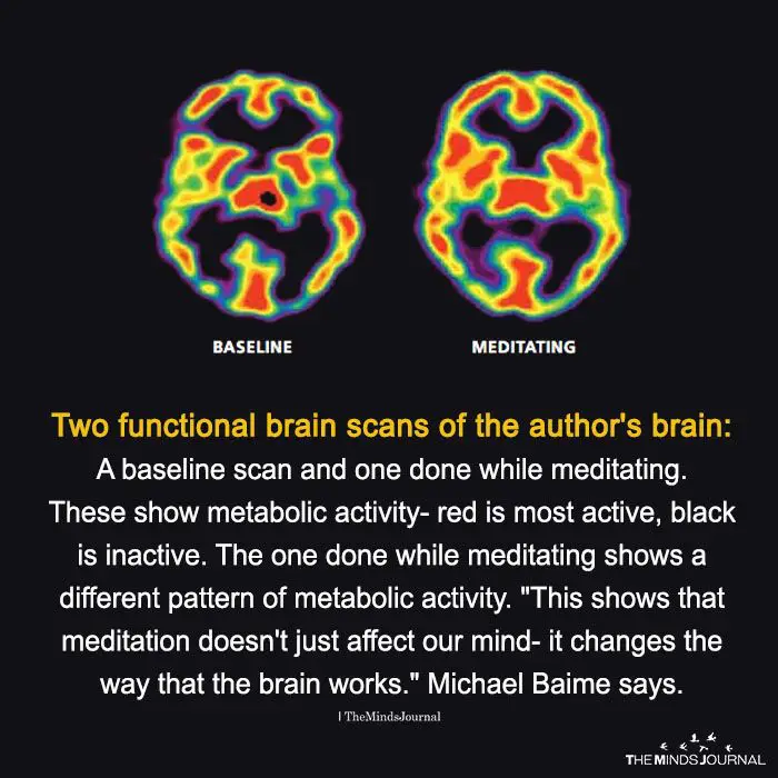 The difference in brain structure of people who meditate and those who don't.