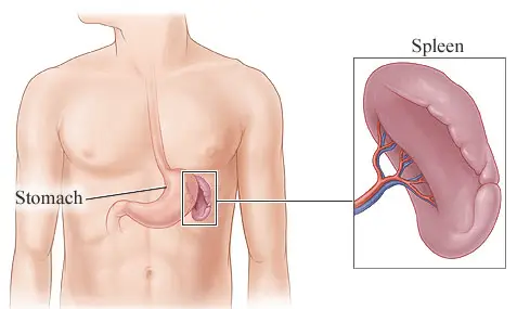 spleen health diagram