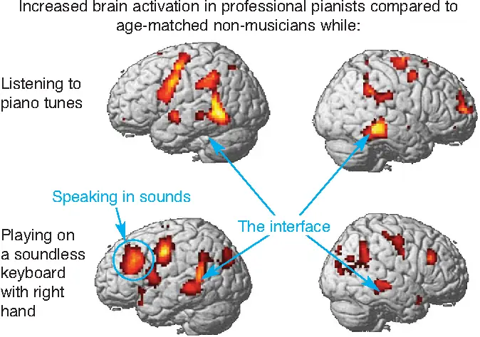 Increased brain activation in professional pianists compared to age-matched non-musicians. 