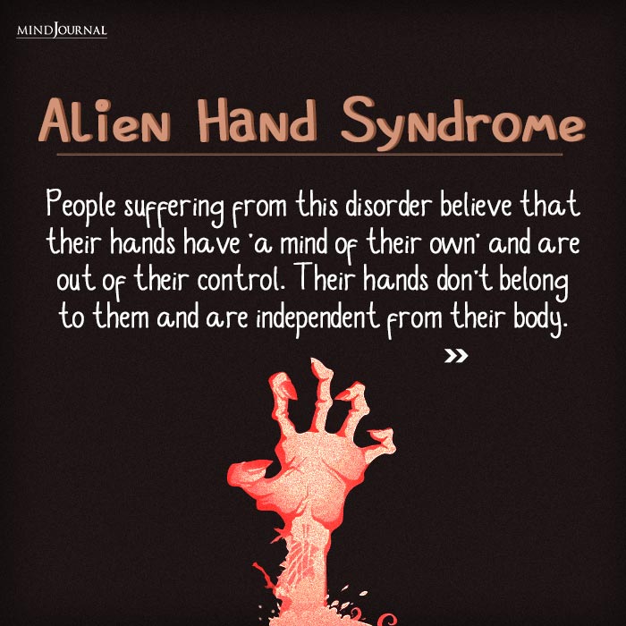 alien hand syndrome