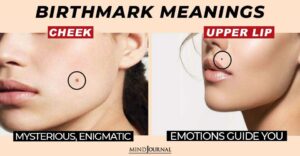 What Does Birthmark Say About You