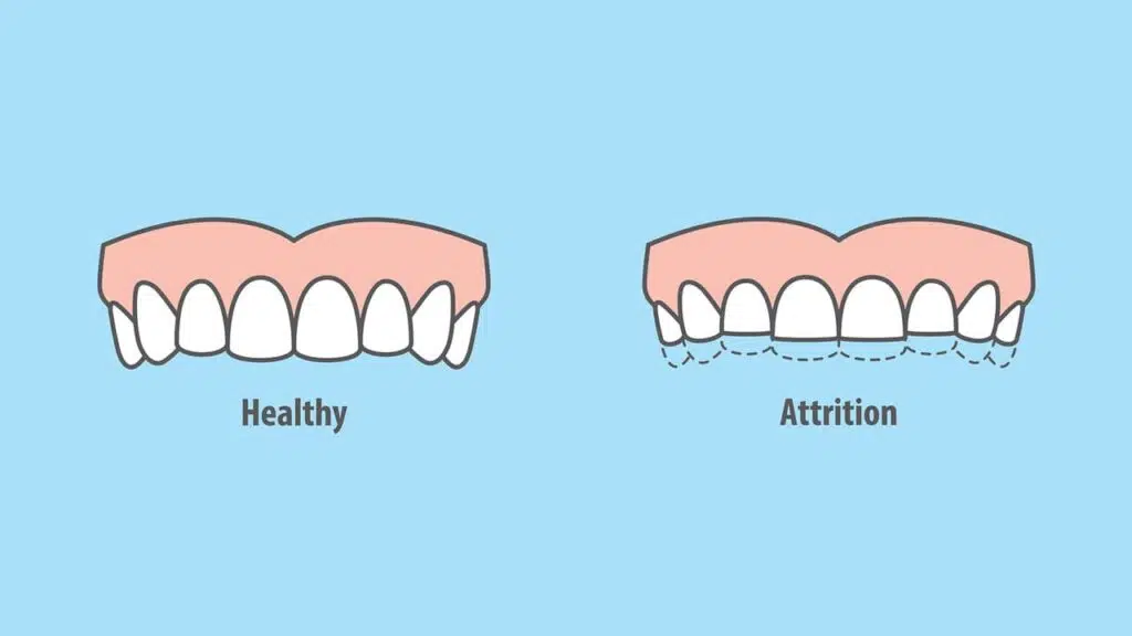 What Your Teeth Say About You 