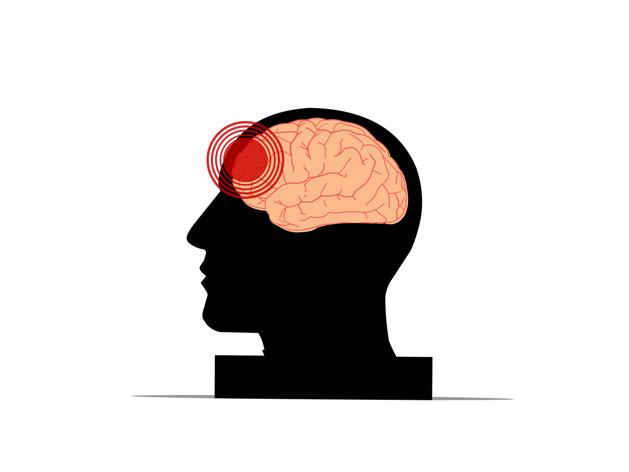 Signs That You May Have Suffered a Brain Injury