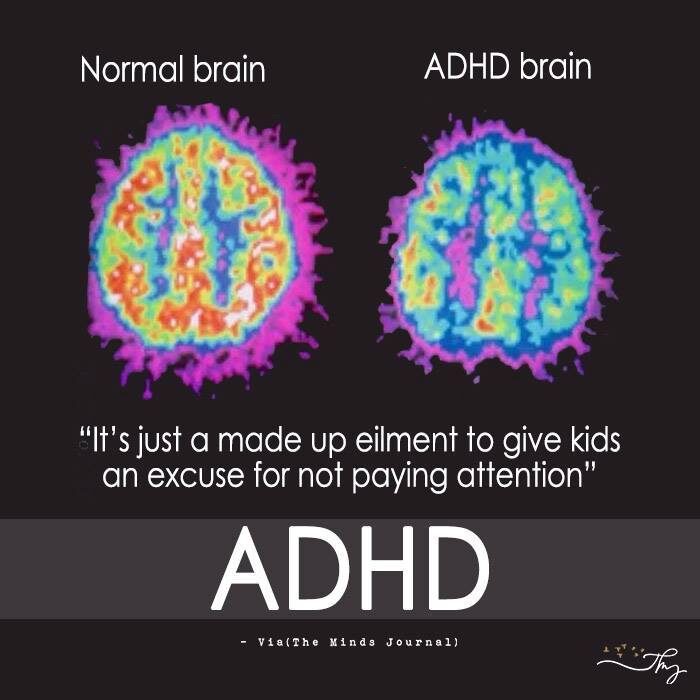 Understanding how ADHD brains work