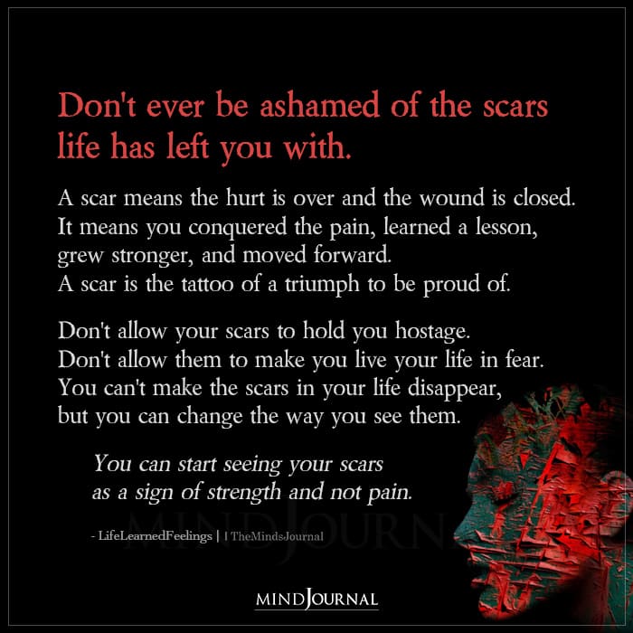 Dont Ever Be Ashamed Of The Scars Life Has Left You With