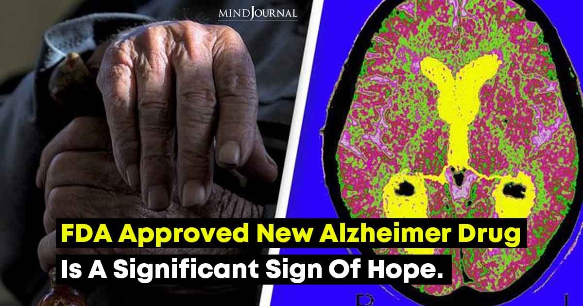 New Alzheimer Drug Is A Turning Point Against Alzheimer