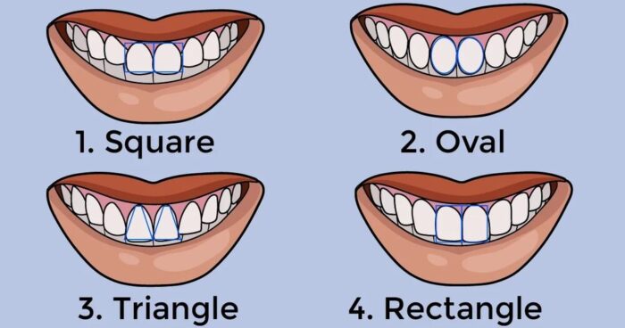 Teeth shape personality test to test your personality