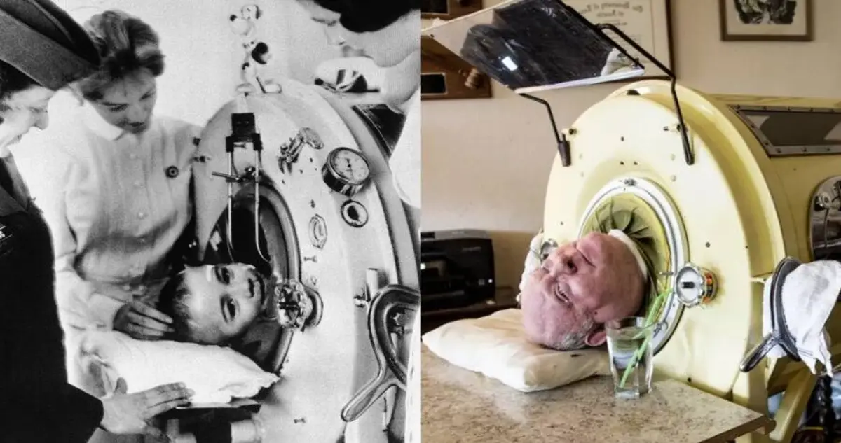 Polio Paul’s Remarkable 70-Year Survival Inside An Iron Lung