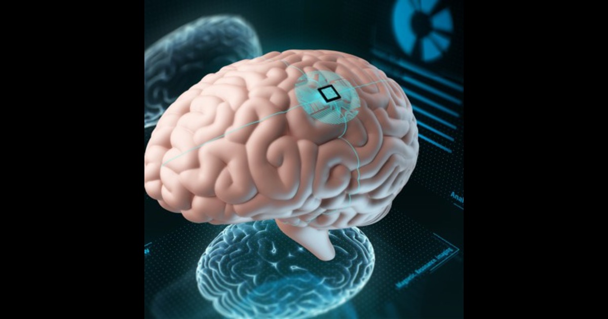 Wireless Brain Implants: Unleashing the Power of Thought