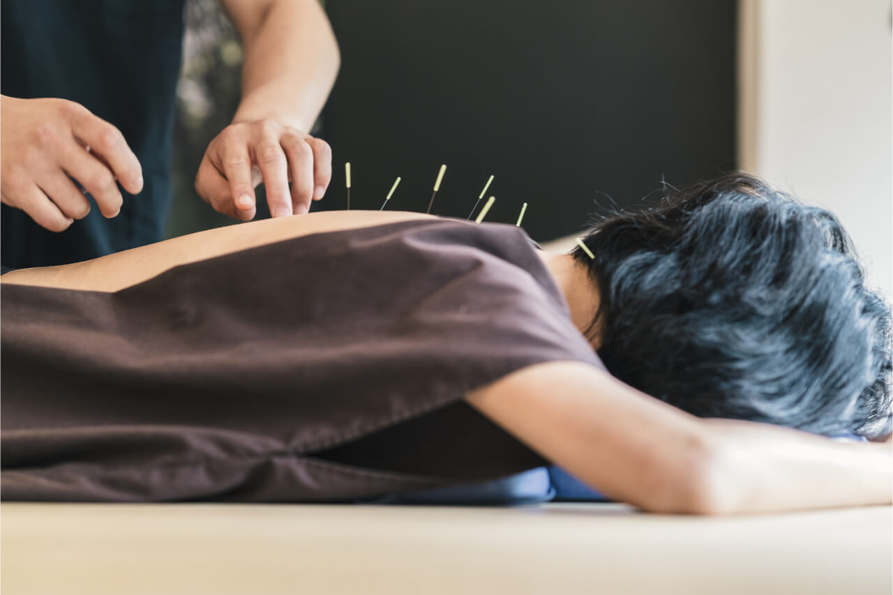 Proven Relief: 5 Conditions Acupuncture Successfully Treats