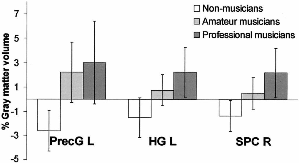 Differences in brain structure of musicians and non-musicians,