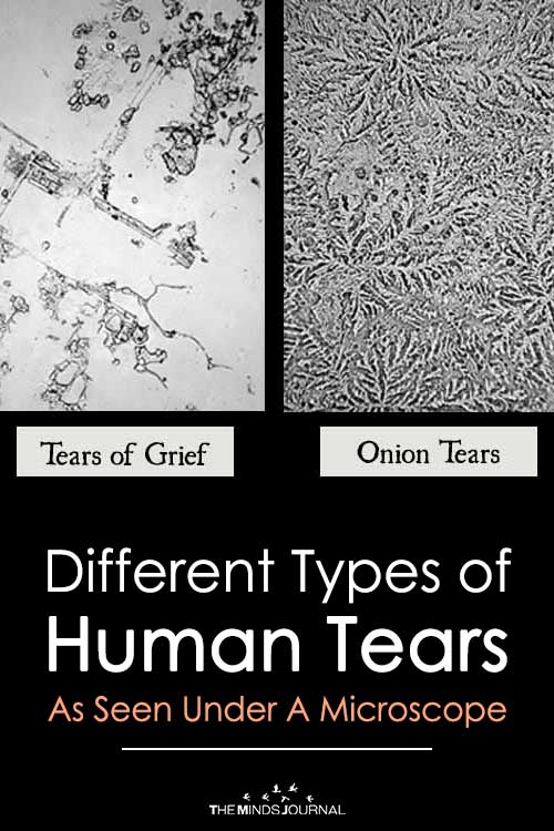 Different Types of Human Tears As Seen Under A Microscope