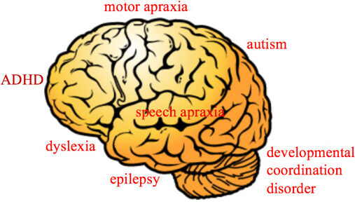 Rob McElhenney diagnosed with neurodevelopmental disorders which include learning disabilities