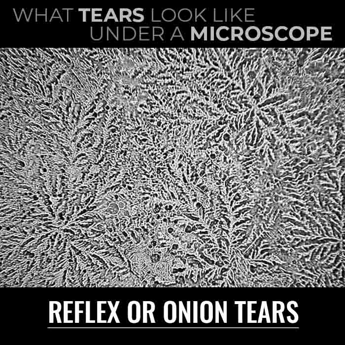 Onion tears under microscope