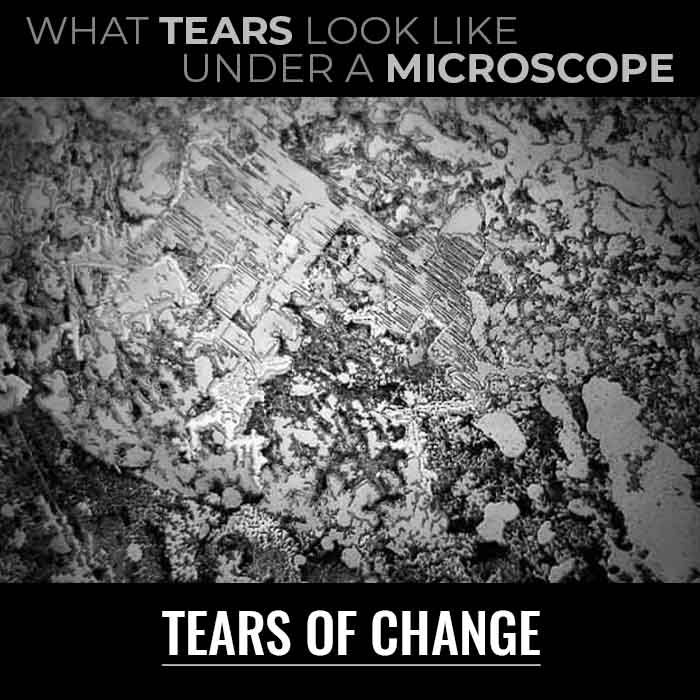 What do tears look like under a microscope?