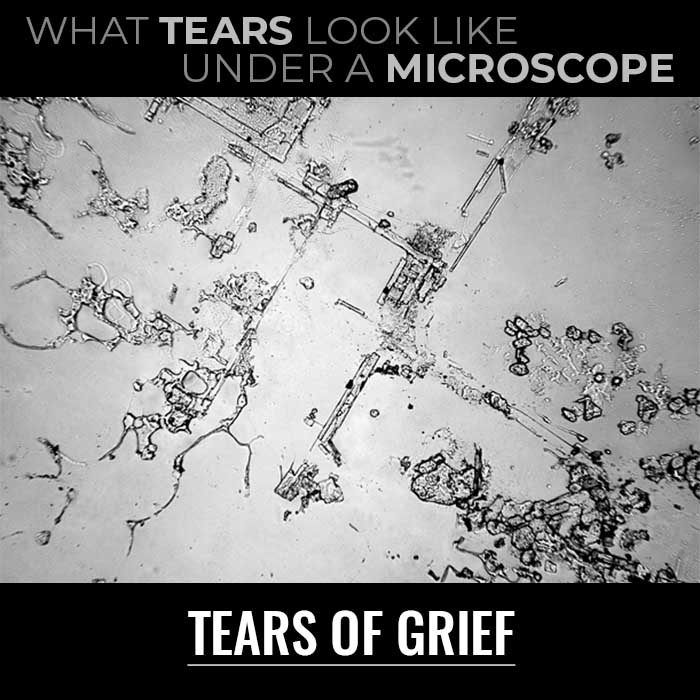 tears under microscope