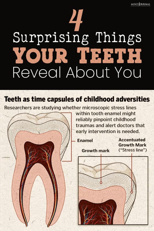 Things Teeth Reveal About You pin