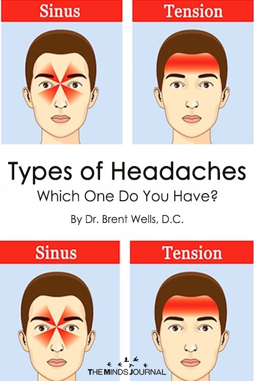 Types of Headaches Which One Do You Have