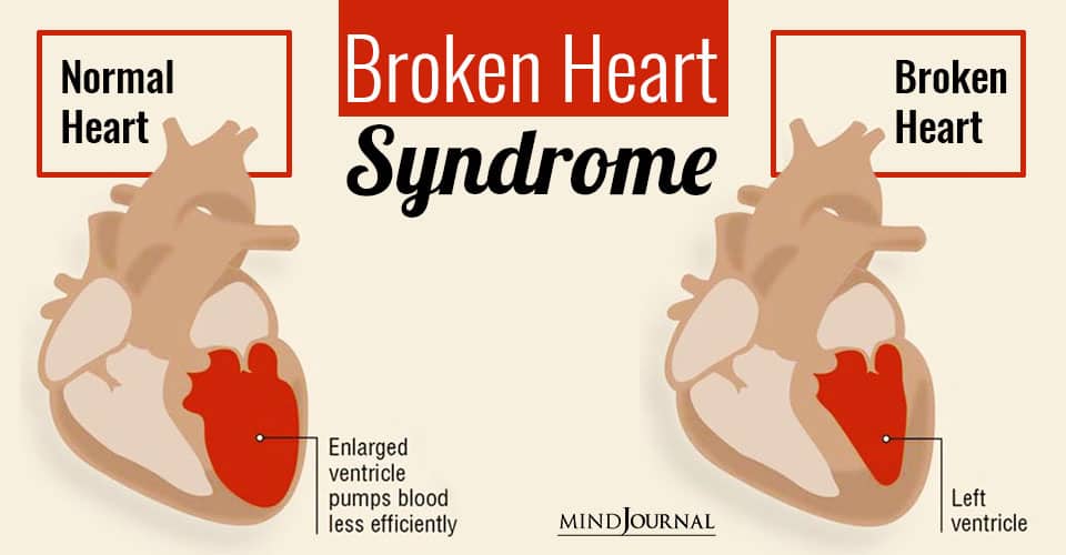 You Can Actually Die From a Broken Heart: New Study Reveals