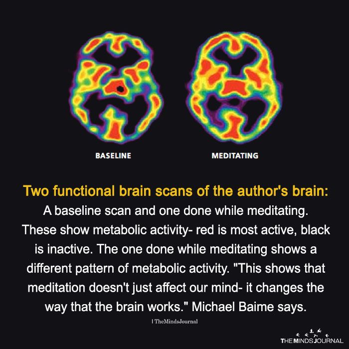 brain scans of a person while meditating 