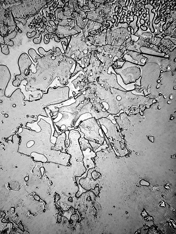 Laughing tears under microscope