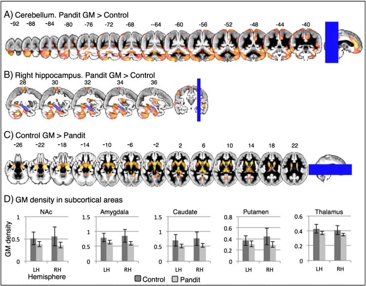 Changes in brain after religious chanting