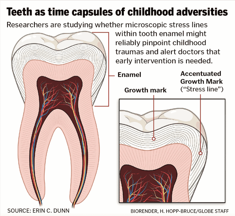 what your teeth say about you