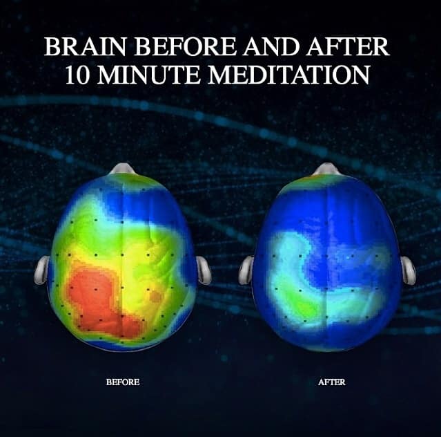 brain after meditation