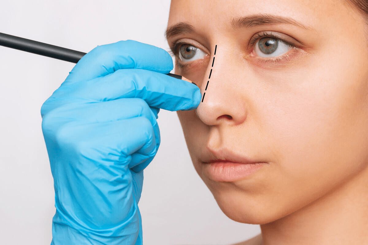 When Deviated Septum Treatment Becomes Medically Necessary