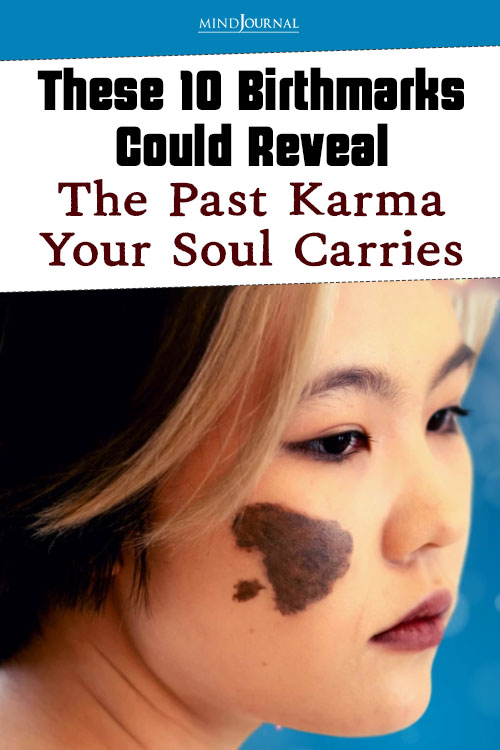 birthmark past life meaning