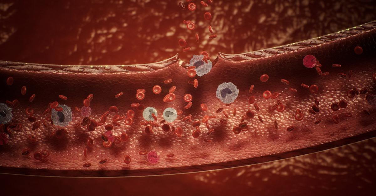 Understanding Hemophilia: Diagnosis and Evaluation